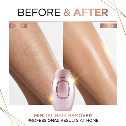 Pain-Free Mini IPL Laser Hair Removal – Smooth Skin in Minutes